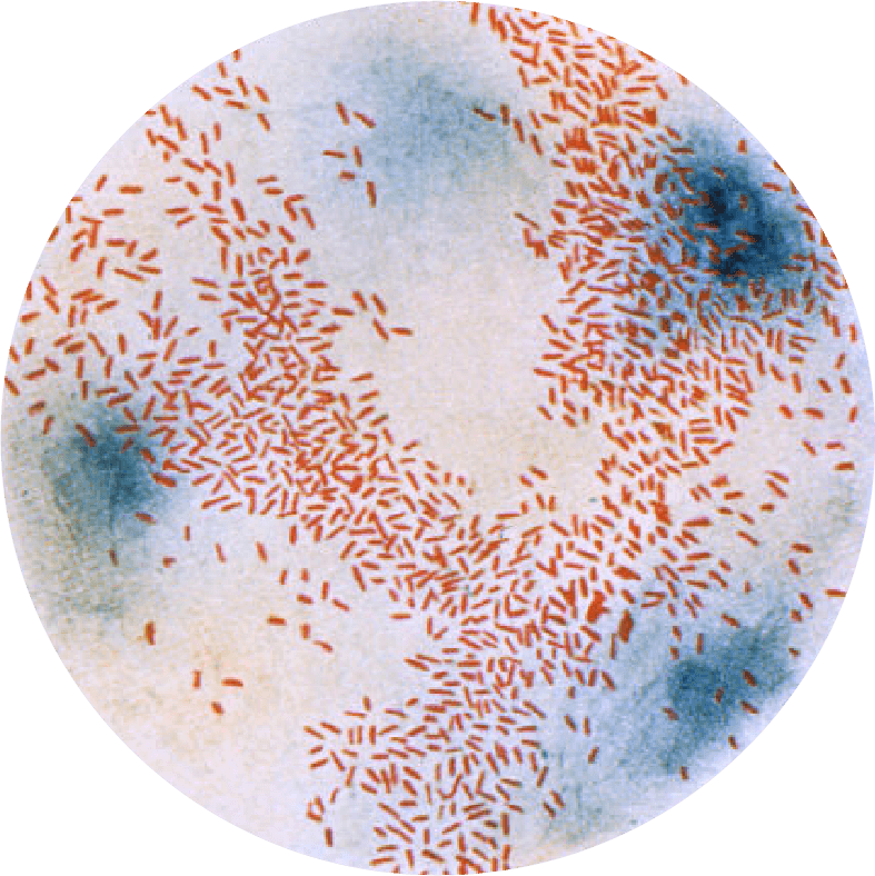 Microscopic view of Streptococcus pneumoniae bacteria